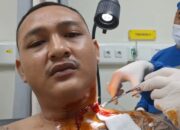 Tragis : Akibat Pembacokan Seorang Pria Terluka Parah di PT Sjim, Polisi Buru Pelaku